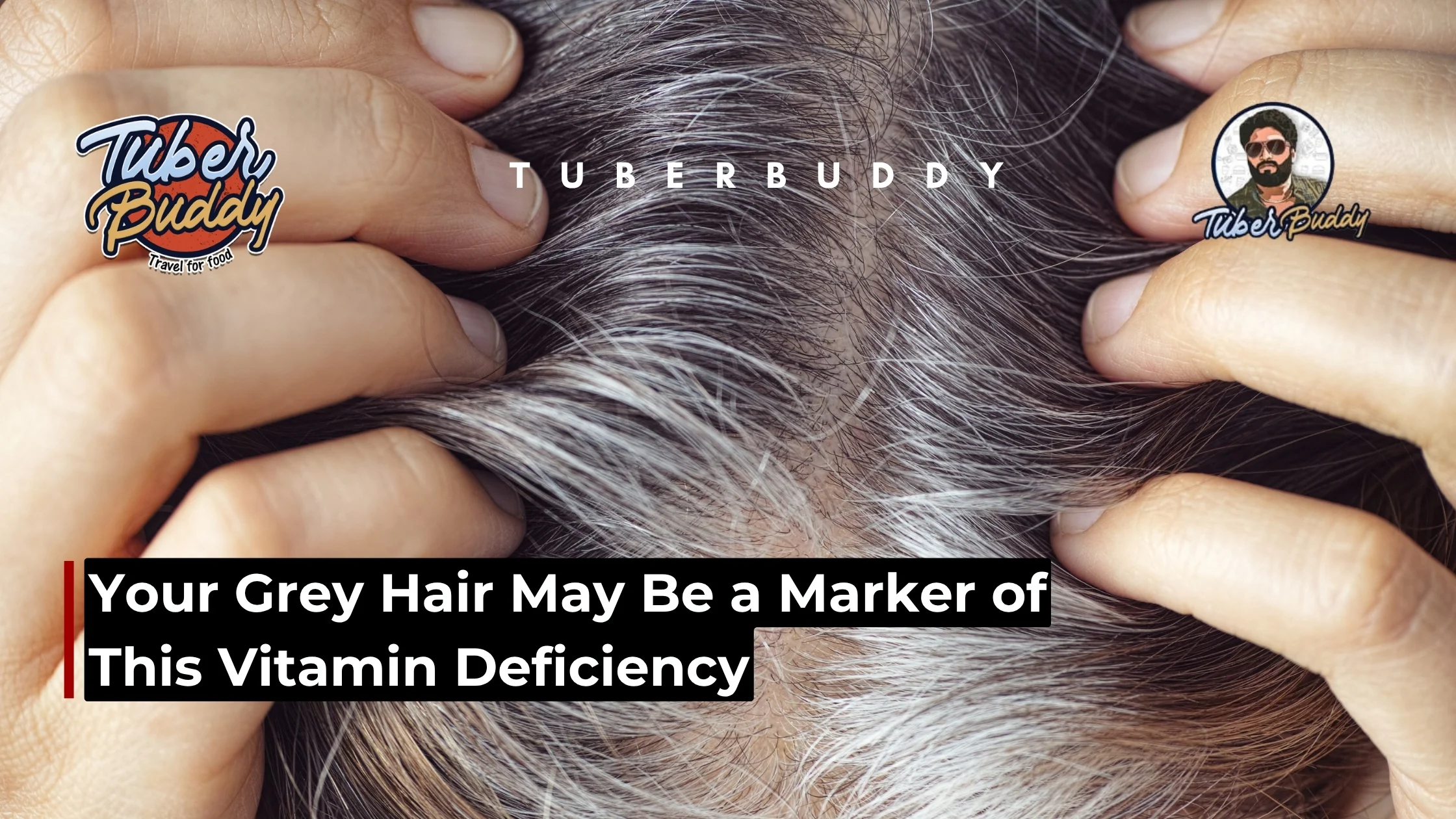 Your Grey Hair May Be a Marker of This Vitamin Deficiency